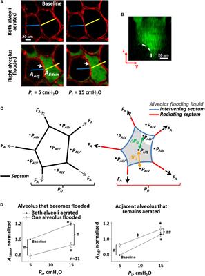 The Contribution of Surface Tension-Dependent Alveolar Septal Stress Concentrations to Ventilation-Induced Lung Injury in the Acute Respiratory Distress Syndrome